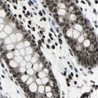 Immunohistochemical staining of human colon using Anti-BCLAF1 antibody HPA006669.