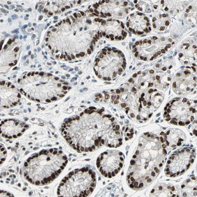 Anti-ZKSCAN1 Antibody