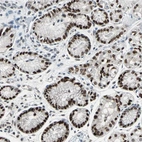 Anti-ZKSCAN1 Antibody