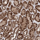 Anti-ZNF445 Antibody