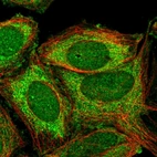 Immunofluorescent staining of human cell line SiHa shows localization to nucleus, cytosol & mitochondria.