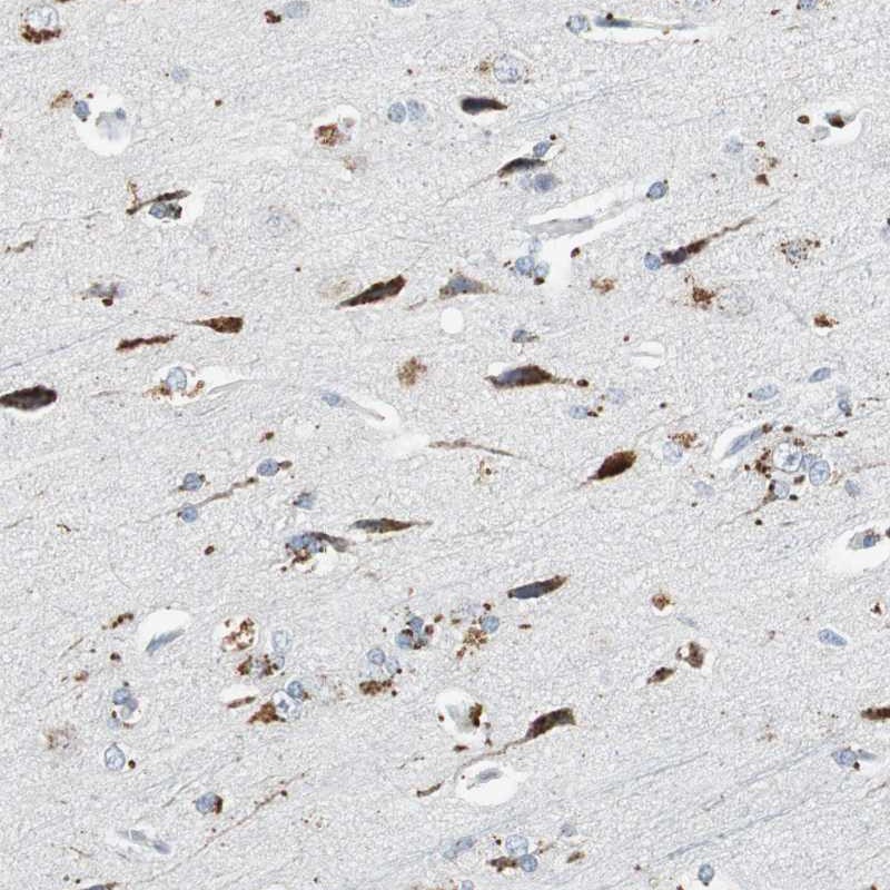 Anti-NLGN1 Antibody