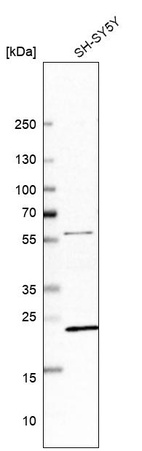 Anti-ZNF396 Antibody