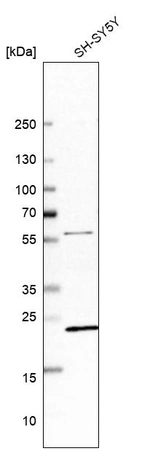 Western blot analysis in human cell line SH-SY5Y.
