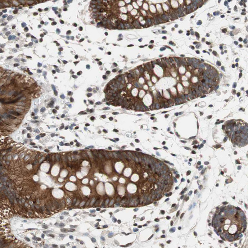 Anti-ZNF512B Antibody