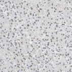Immunohistochemical staining of human liver shows moderate nuclear and nucleoli positivity in hepatocytes.