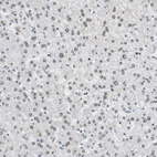 Immunohistochemical staining of human liver shows moderate nuclear and nucleoli positivity in hepatocytes.