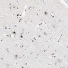 Immunohistochemical staining of human cerebral cortex shows strong nuclear and nucleoli positivity in neurons.