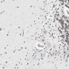 Immunohistochemical staining of human cerebellum shows moderate nuclear and nucleoli positivity in Purkinje cells, molecular layer cells and granular layer cells.