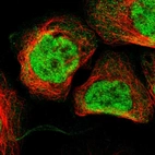 Immunofluorescent staining of human cell line A-431 shows localization to nucleoplasm.