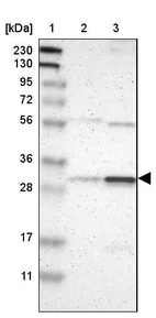Lane 1: Marker [kDa] 230, 130, 95, 72, 56, 36, 28, 17, 11_br/_Lane 2: Human cell line RT-4_br/_Lane 3: Human cell line U-251MG sp