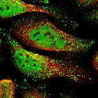 Immunofluorescent staining of human cell line U-2 OS shows localization to nucleoplasm & vesicles.
