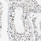 Immunohistochemical staining of human testis shows high expression.