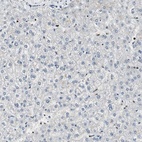 Immunohistochemical staining of human liver shows low expression as expected.
