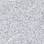 Anti-PAXIP1 Antibody