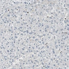 Immunohistochemical staining of human liver shows low expression as expected.
