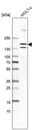 Western blot analysis in human cell line MOLT-4.