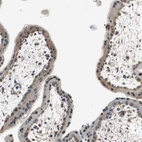 Immunohistochemical staining of human placenta shows moderate cytoplasmic positivity in trophoblastic cells.