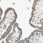 Immunohistochemical staining of human placenta shows moderate cytoplasmic positivity in trophoblastic cells.