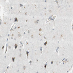 Immunohistochemical staining of human cerebral cortex shows moderate cytoplasmic positivity in neuronal cells.