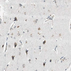 Immunohistochemical staining of human cerebral cortex shows moderate cytoplasmic positivity in neuronal cells.