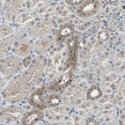 Immunohistochemical staining of human kidney shows moderate cytoplasmic positivity in cells in distal tubules.