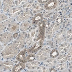 Immunohistochemical staining of human kidney shows moderate cytoplasmic positivity in cells in distal tubules.