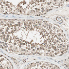 Anti-PSMD8 Antibody