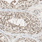 Anti-PSMD8 Antibody
