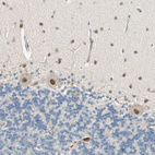 Immunohistochemical staining of human cerebellum shows moderate nuclear positivity in Purkinje cells.