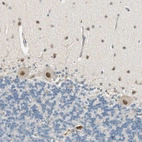 Immunohistochemical staining of human cerebellum shows moderate nuclear positivity in Purkinje cells.