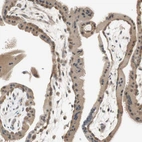 Immunohistochemical staining of human placenta shows moderate cytoplasmic positivity in trophoblastic cells.