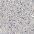 Anti-PSMD8 Antibody