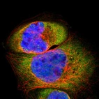 Immunofluorescent staining of human cell line A-431 shows localization to cytosol.
