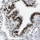 Anti-XRCC1 Antibody