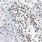 Anti-XRCC1 Antibody