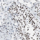 Immunohistochemical staining of human testis shows strong nuclear positivity in cells in seminiferous ducts.