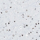 Immunohistochemical staining of human cerebral cortex shows strong nuclear positivity in neurons.