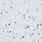 Immunohistochemical staining of human cerebral cortex shows strong nuclear positivity in neurons.