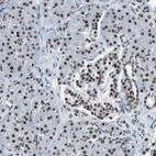 Anti-XRCC1 Antibody