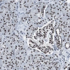 Immunohistochemical staining of human pancreas shows strong nuclear positivity in exocrine glandular cells.