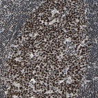 Anti-TERF2IP Antibody