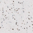 Immunohistochemical staining of human cerebral cortex shows moderate nuclear positivity in neuronal cells.