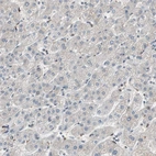 Immunohistochemical staining of human liver shows no positivity in hepatocytes.