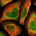Immunofluorescent staining of human cell line U-2 OS shows localization to nucleoplasm & cytosol.