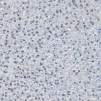 Immunohistochemical staining of human liver shows low expression as expected.