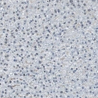 Immunohistochemical staining of human liver shows low expression as expected.