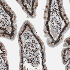 Immunohistochemical staining of human small intestine shows high expression.