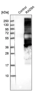 Western blot analysis in control (vector only transfected HEK293T lysate) and RAD9A over-expression lysate (Co-expressed with a C-terminal myc-DDK tag (~3.1 kDa) in mammalian HEK293T cells, LY401451).