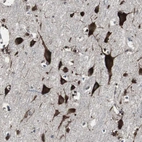 Immunohistochemical staining of human cerebral cortex shows strong cytoplasmic positivity in neurons.